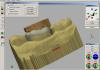 CEREC® Virtual Articulator